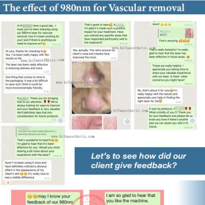 GOOD Feedback -- 980nm Laser Vascular Removal Machine